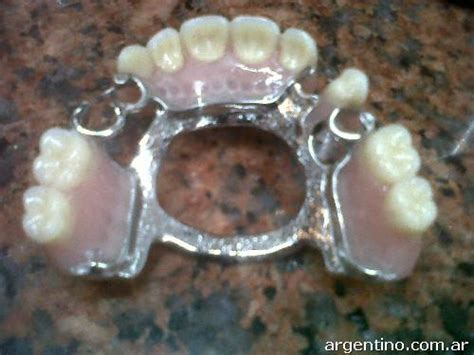 Protesista Dental / Mecánica Dental en Haedo: teléfono