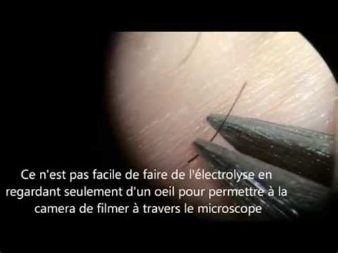 Lectrolyse Au Microscope Microelectrolyse Microtrolyse