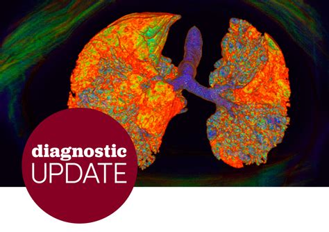 Improving The Diagnosis Of Interstitial Lung Disease Pulmonology Advisor