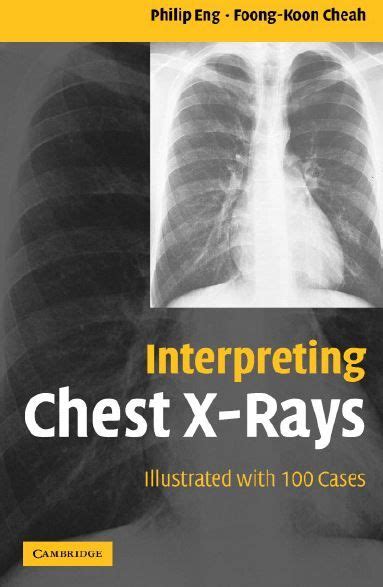 Interpreting Chest X Rays Illustrated With Cases Medical