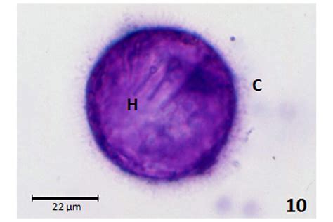 Coracidium Of D Latus Hooks H Of Hexacanth Larva And Cilia C