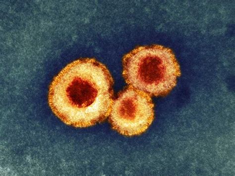 Human Metapneumovirus Vaccine - Creative Biolabs