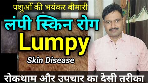 लम्पी स्किन रोग देसी उपचार Lumpy Skin Disease Desi Treatment लंपी रोग