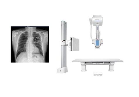 Vuno Samsung To Integrate Ai Solution With Digital Radiography System