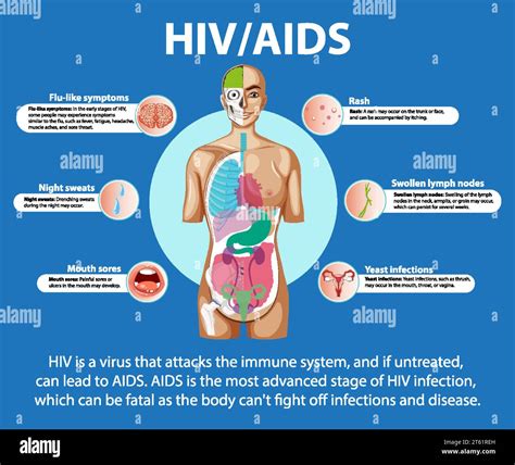 Illustration Depicting The Effects Of Hiv Aids On The Brain Mouth