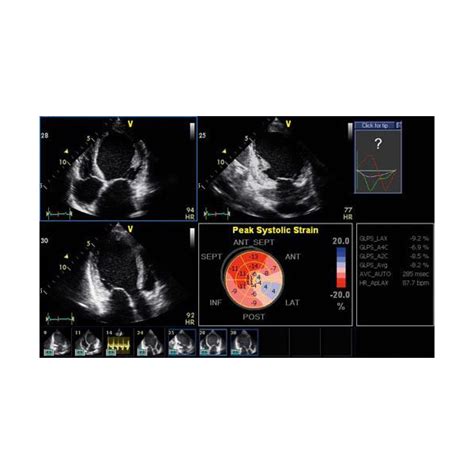 Ge Vivid Q Ultrasound Machine Refurbished Medpick