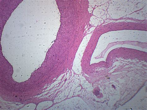 Human Artery Vein And Nerve Cross Section Prepared Microscope Slide