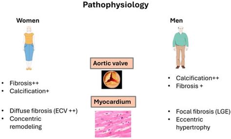 Sex Related Differences In The Pathophysiology Cardiac Imaging And