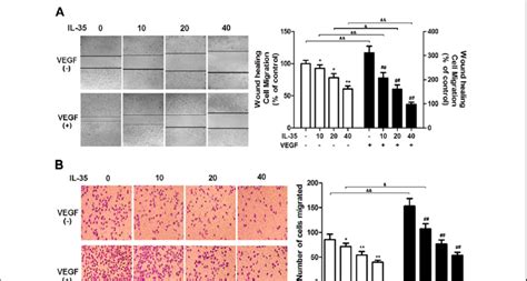 Il 35 Inhibits Basal And Vegf 165 Induced Huvec Wound Healing And Download Scientific Diagram