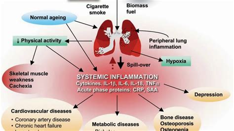 Difference Between Copd And Asthma Youtube