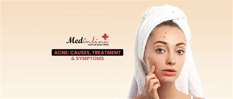 Acne: Causes, Treatment & Symptoms - Medonline.pk