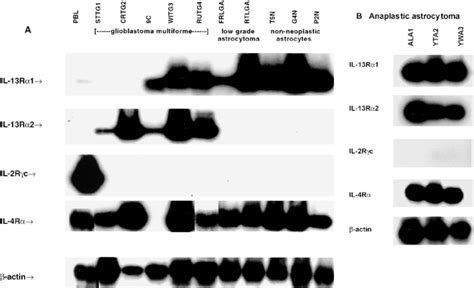 A, B Distribution of interleukin-13 (IL-13) receptor (R) expression in ...