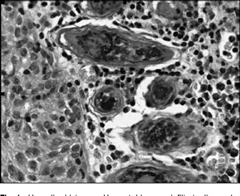 Figure 1 From A Case Of Chronic Schistosomiasis Four Years After Infestation Semantic Scholar