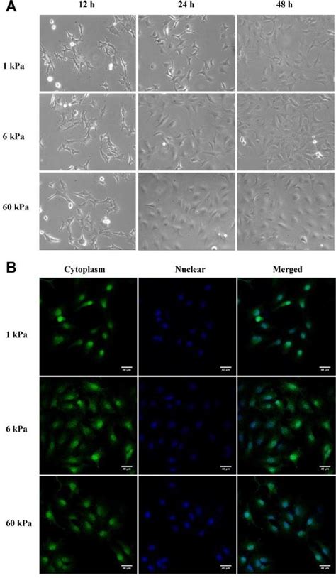 Cell Morphology Closely Correlate With Substrate Rigidity A Typical