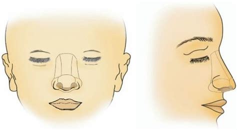 Nasal Subunits The Nose Can Be Divided Into The Tip Dorsal Download Scientific Diagram