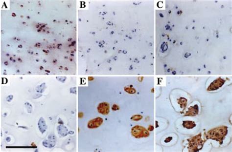 Micrographs Representing Immunolocalisation Of Chondrocytes Passaged