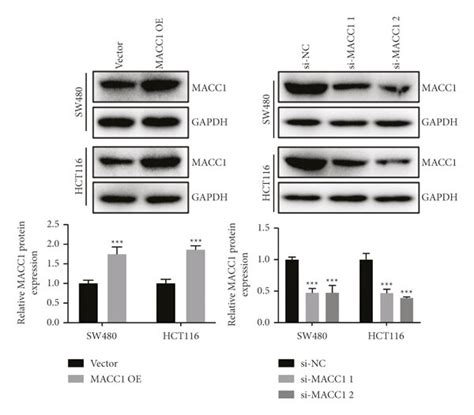 The Expression Of Macc1 In Sw480 And Hct116 Cell Lines A Rt Qpcr Download Scientific Diagram