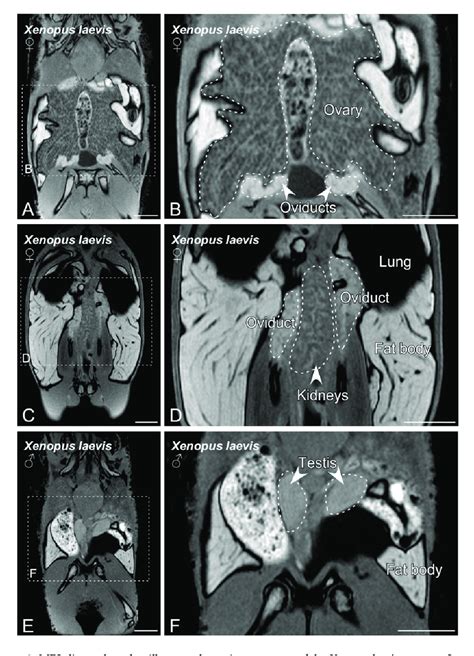 Mri Slices Selected To Illustrate The Main Sex Organs Of The Xenopus