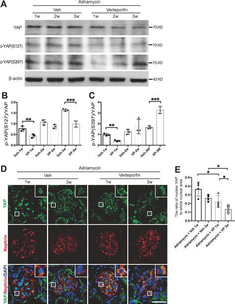 Nuclear Exclusion Of YAP Exacerbates Podocyte Apoptosis And Disease