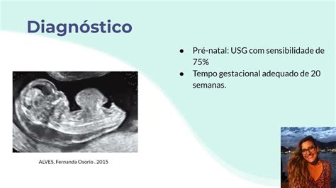 AMC 2 2020 09 ANATOMIA APLICADA À ONFALOCELE YouTube