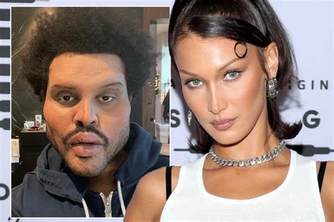 The Weeknd Plastic Surgery Vacationbewer