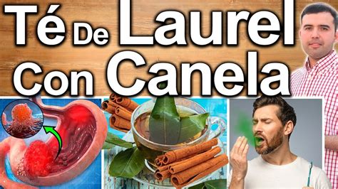 Poderoso Te De Hoja De Laurel Y Canela En Ayunas Para Que Sirve Y