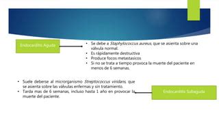 Endocarditis Bacteriana PPT