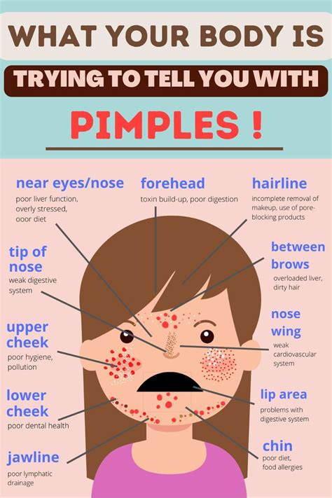 Acne And Health What Your Body Is Trying To Tell You With Pimples 🌸 Skin Care Tips How To