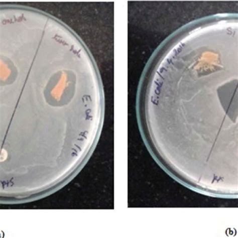 A Formation Of Zone Of Inhibition Against Staphylococcus Aureus And