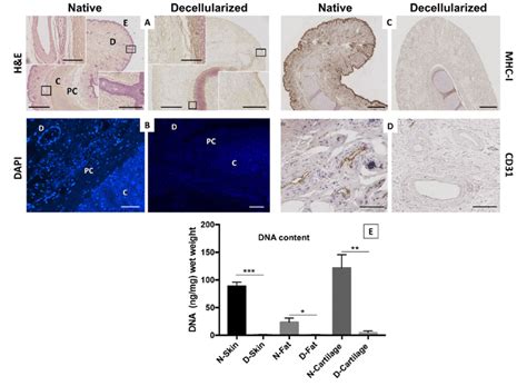 Cells And Antigens Removal A H E Staining Comparing Native Left And