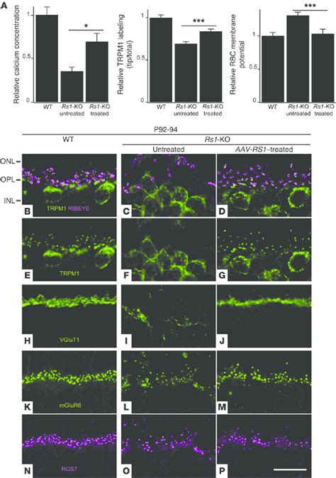 RS1 Gene Transfer Restores Photoreceptor Calcium Homeostasis And TRPM1