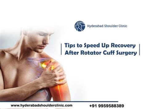 Tips To Speed Up Recovery After Rotator Cuff Surgery Shoulder Clinic