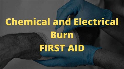 Chemical And Electrical Burn First Aid Youtube