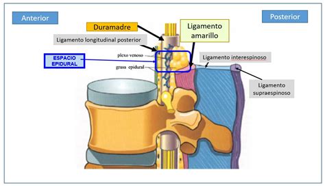 Neuroestimulación Medular Em O Scs Dolopedia