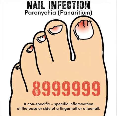 Grabovoi Number Frequency To Heal Nail Infection Health Spell Yoga