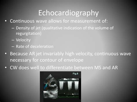 Ppt Aortic Insufficiency Powerpoint Presentation Free Download Id 3385197