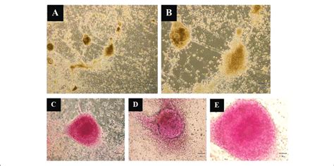 Dithizone Dtz Staining The Cells After Days Of Differentiation