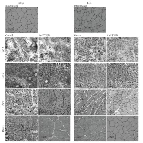 Histological Aspects Of Regenerating Soleus And Edl Muscles