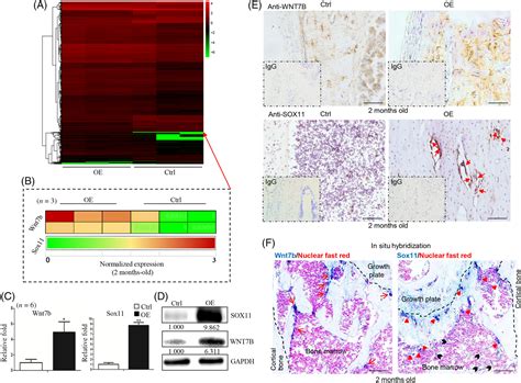 Wnt Binduced Sox Functions Enhance Selfrenewal And Osteogenic