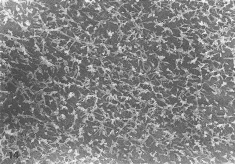 Parietal Pleura Of Chest Wall Flattened Mesothelial Cells Covered With