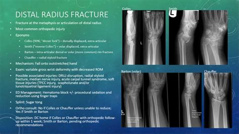 Barton Fracture