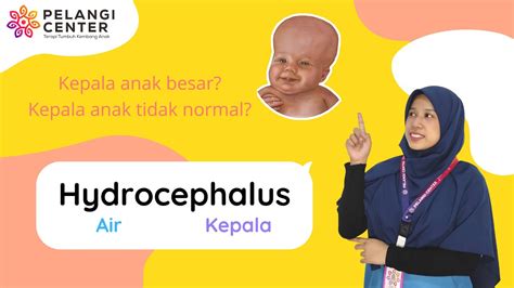 Ukuran Kepala Anak Tidak Normal Deteksi Dini Hydrocephalus Pelangi Center Youtube