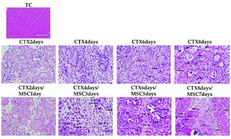 Hematoxylin And Eosin Staining In The Skeletal Muscle Tc Is The Total