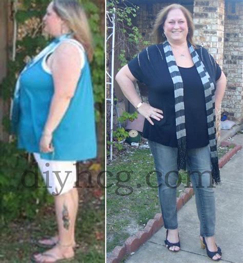 HCG Success Stories: Tammy's HCG Before and After