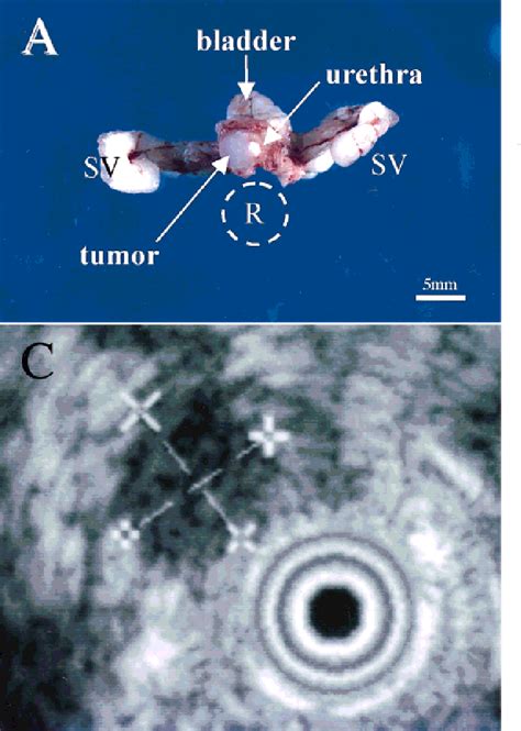 PDF Transrectal Ultrasound For Monitoring Murine Orthotopic Prostate