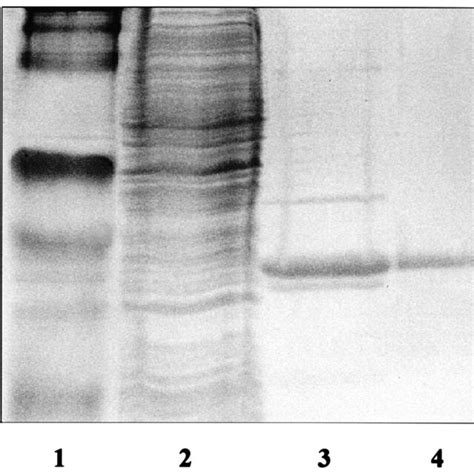 Expression And Puri Fi Cation Of Farr His Protein Samples Collected