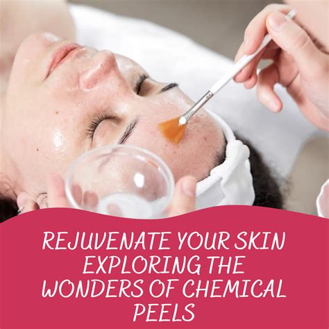 Rejuvenate Your Skin Exploring The Wonders Of Chemical Peels Olive