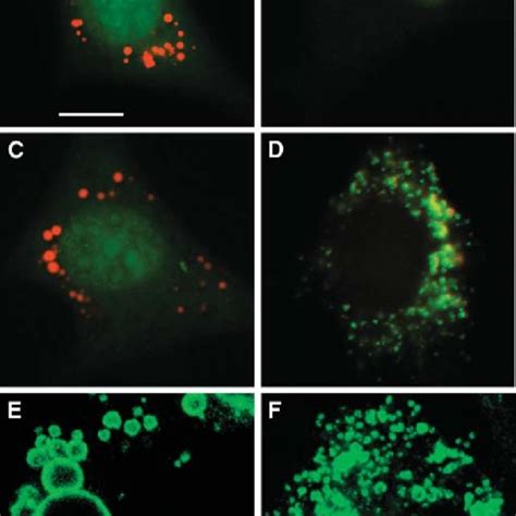 Lipid Droplet Remodeling Under Basal Conditions Lipid Droplets Form Download Scientific