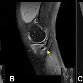 Magnetic Resonance Images Of The Patient S Knee A Axial Image