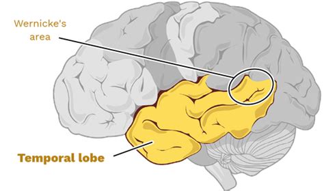 Temporal Lobe Labster